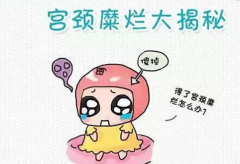 这五招教你如何查宫颈糜烂？