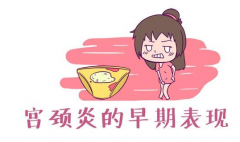 宫颈炎到底有哪些症状表现？