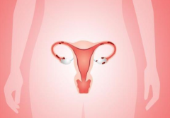 宫颈息肉手术多少钱？