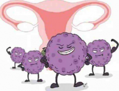 宫颈襄肿怎么治疗？