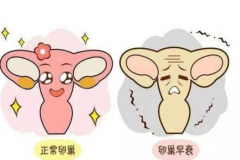 月经不调有什么症状？