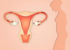 宫颈肥大会造成宫颈性不孕吗?