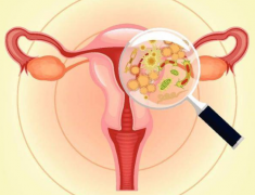 哪些时期女性易患阴道炎?