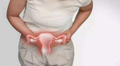 怎么避免宫颈炎？