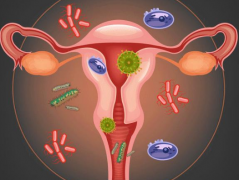 宫颈炎是什么原因引起的？