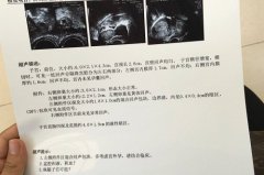 想要有效避免宫外孕 这4种病因千万别触碰-泉州