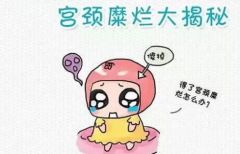 宫颈糜烂成为了女性群体中患发率较高